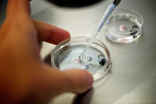 Учёные: «Стрессовые» эмбрионы помогут лучшему зачатию при ЭКО