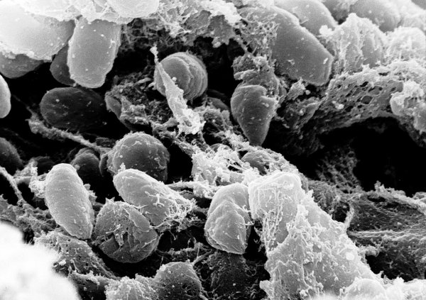 Ученые обнаружили в братской могиле в Швеции следы древней чумы